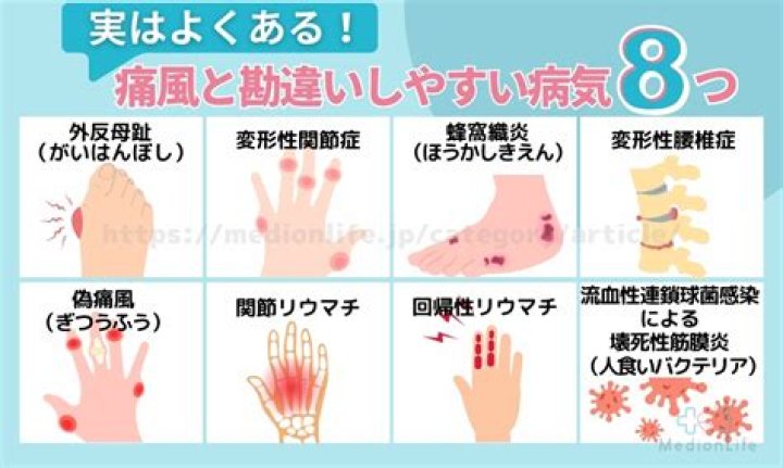 痛風治療で医師に診てもらうイメージ